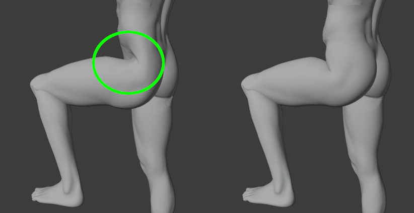 _images/improve_skin_hips.jpg